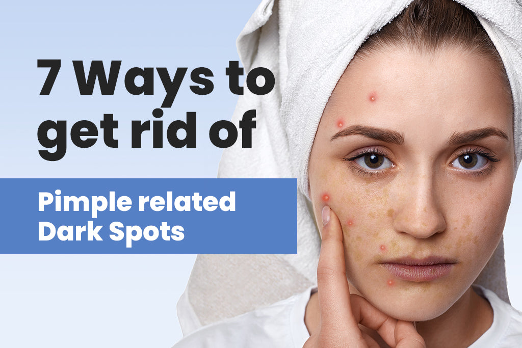 7-ways-to-get-rid-of-pimple-related-dark-spots-olava-naturals